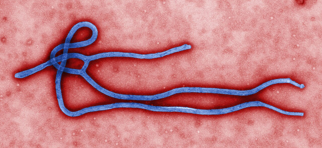 EM image of Ebola virus